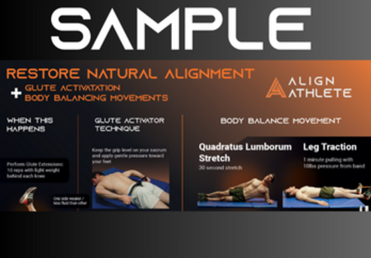 Glute Activator Wall Poster